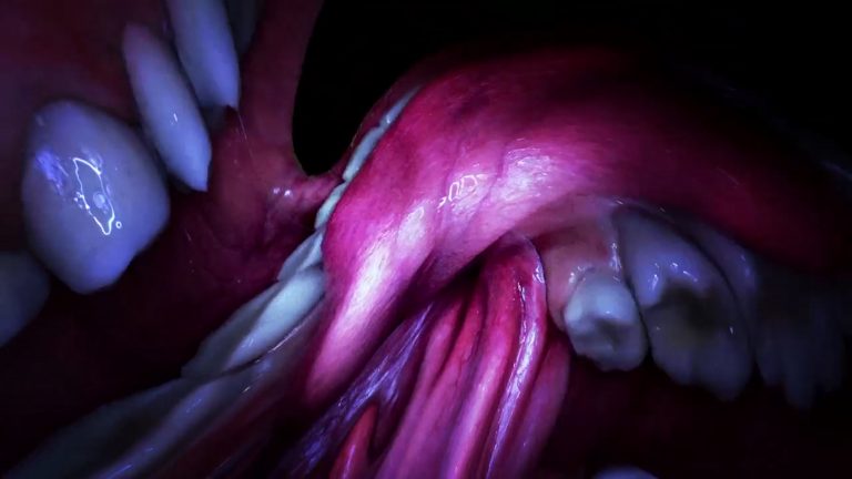 Grand angle sur Björk